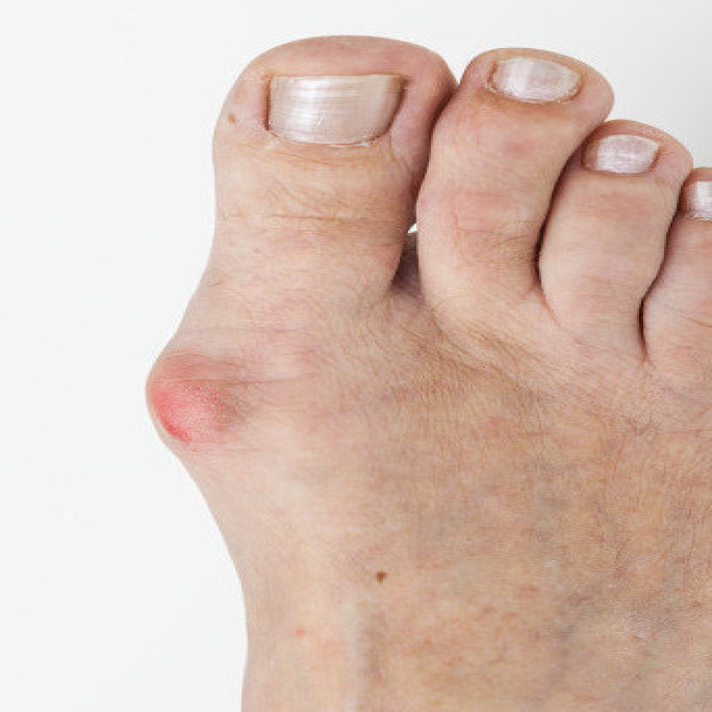 Foot Problems - Alberta Family Podiatry