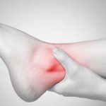 Arthritis in the ankle