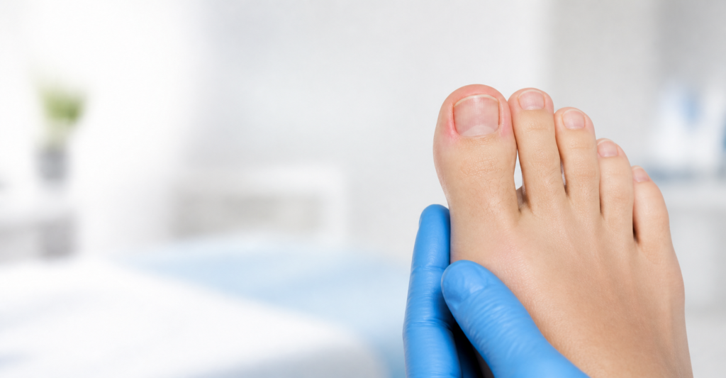 Podiatrist examining an ingrown toenail